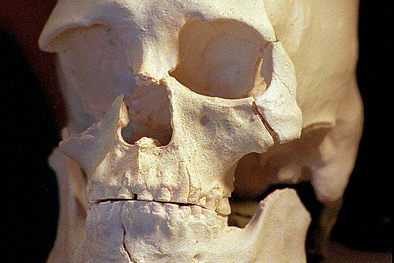 kennewick man essay New genetic evidence suggests that kennewick man, an 8,500-year-old skeleton found in washington state, is related to members of a nearby native american tribe the dna may help resolve a long-running scientific mystery, while at the same time reigniting a debate over who should have custody of the. kennewick man essay New genetic evidence suggests that kennewick man, an 8,500-year-old skeleton found in washington state, is related to members of a nearby native american tribe the dna may help resolve a long-running scientific mystery, while at the same time reigniting a debate over who should have custody of the.