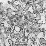Woman found to spread Zika through sex for 1st time