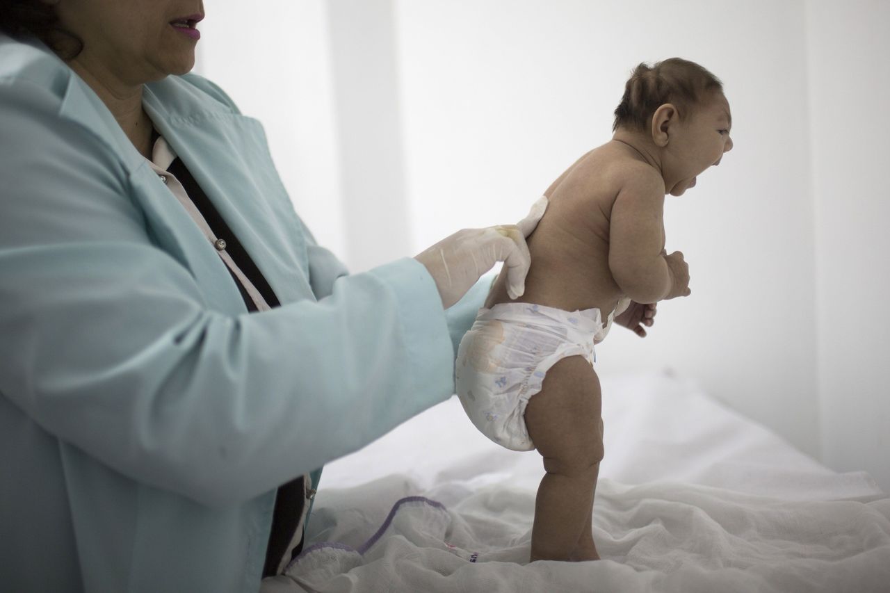 A neurologist examines a less than 3-months old baby born with microcephaly at the Pedro I hospital in Campina Grande, Brazil, in February.