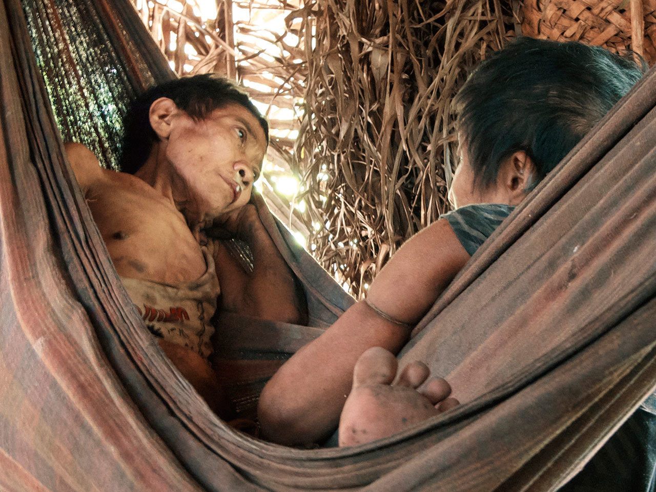 Jakarewãja and Amakaria, two women from the endangered Aw tribe from the Brazilian Amazon are seen while sick with tuberculosis after being led out of the forest in 2015 photo. (Survival International)