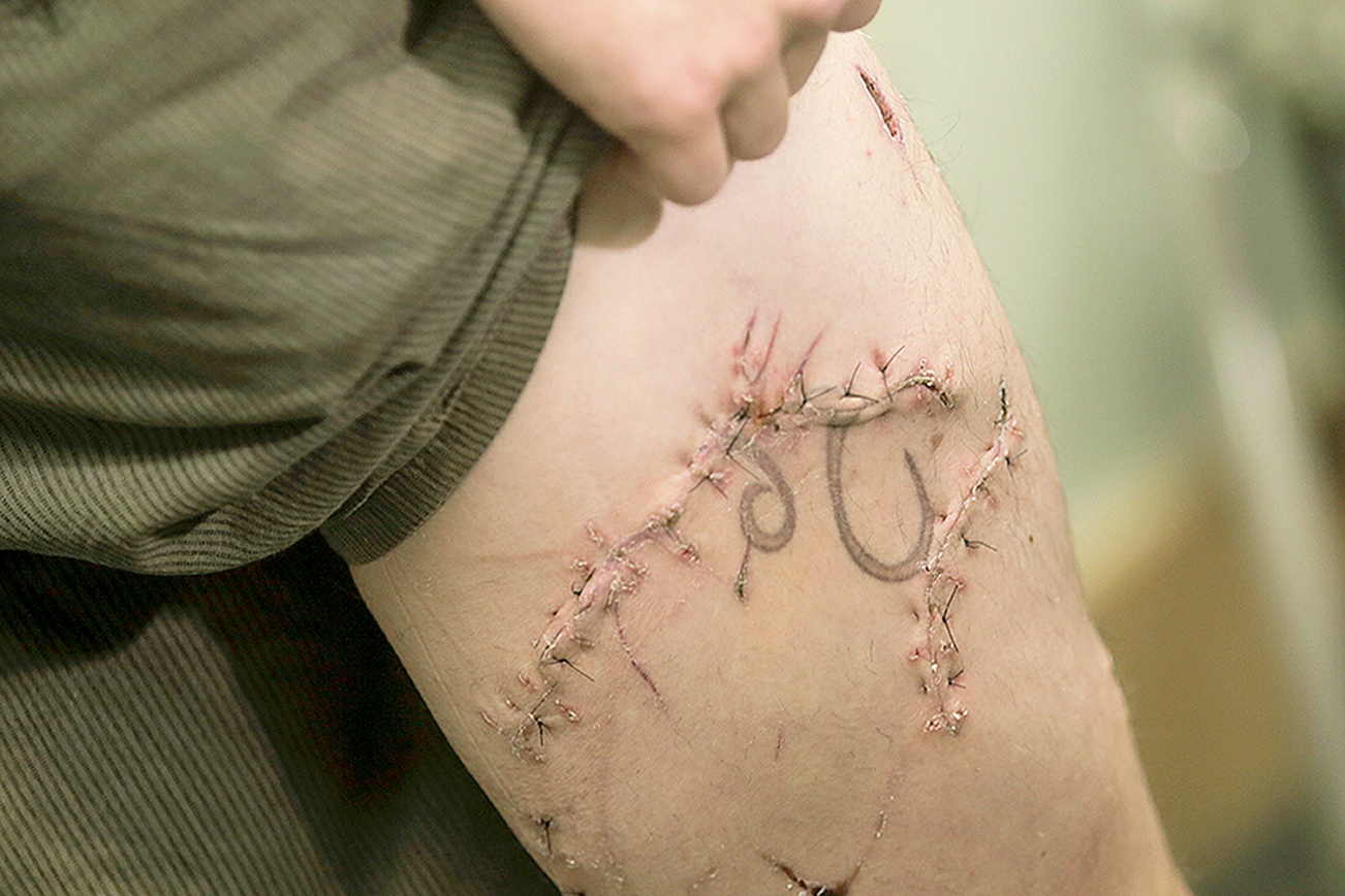 Oregon surfer punched shark in gills to survive