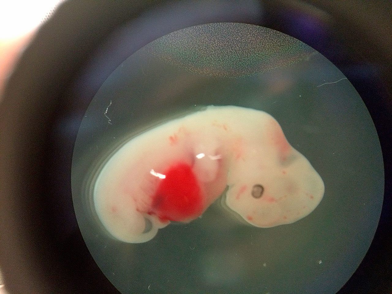 This undated photo shows a 4-week-old pig embryo which had been injected with human stem cells. (Salk Institute via AP)
