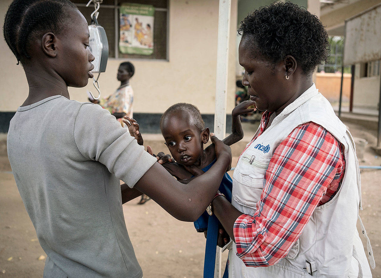 A mother (left) takes her son after he was weighed and found to be suffering from severe acute malnutrition at Al Sabbah Children’s Hospital in Juba, South Sudan. (Mackenzie Knowles-Coursin/UNICEF via AP)