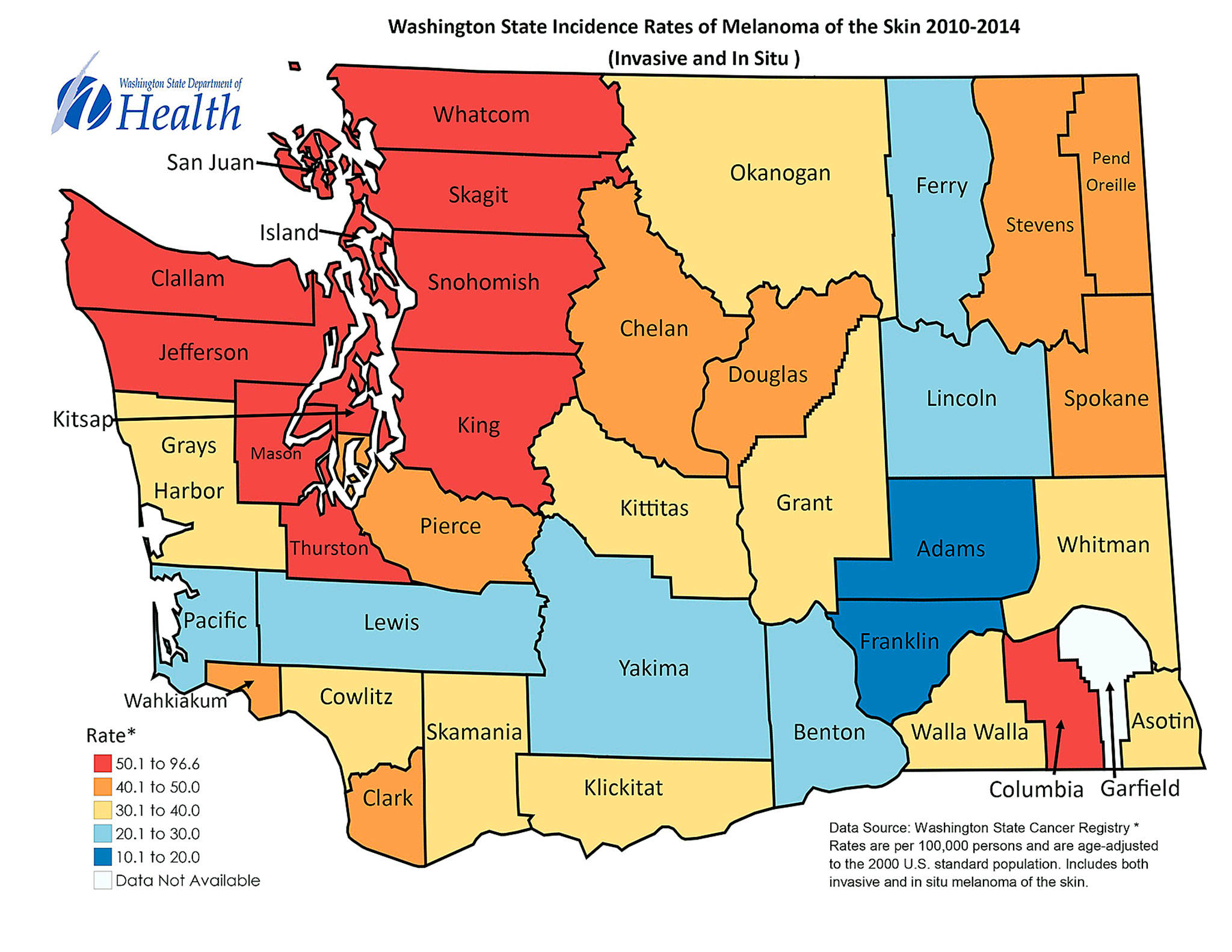 Melanoma rates in Snohomish County exceed state levels