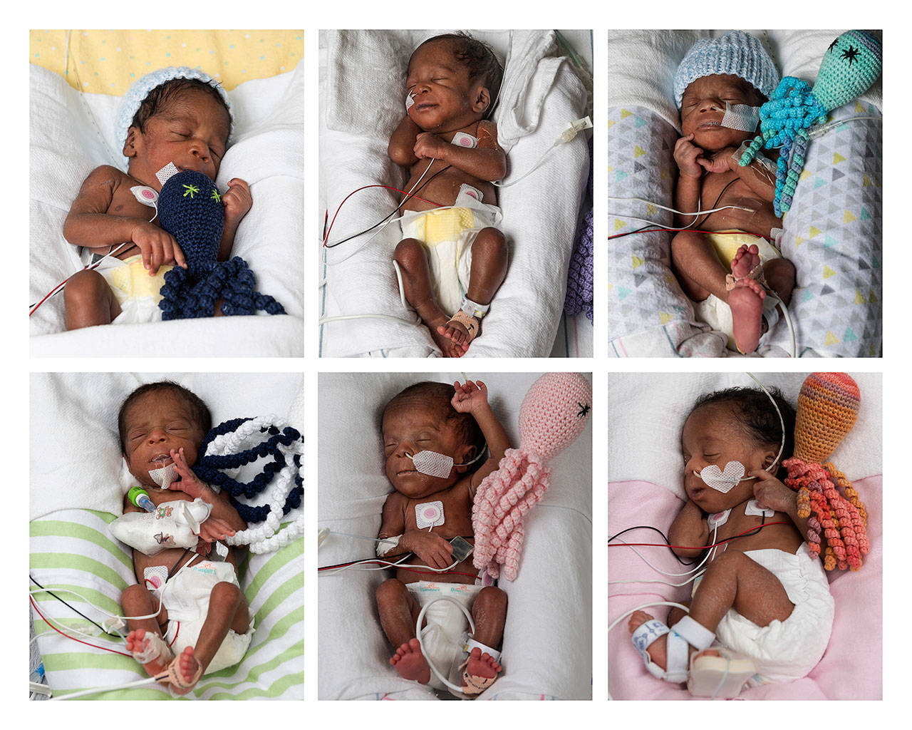 Sextuplets were delivered at 30 weeks at VCU Medical Center in Richmond, Virginia, the first time in the facility’s history for such a large birth. (Allen Jones / Courtesy of VCU Medical Center)