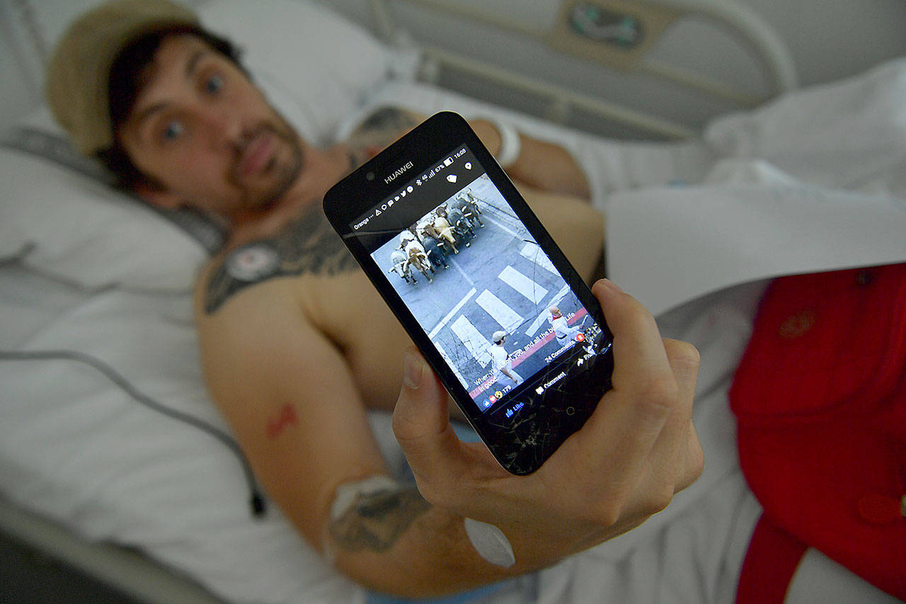 Bill Hillmann, 35, lying in a hospital bed, shows a photo of himself that someone sent to him during a bull run a day before he was gored Saturday. (AP Photo/Alvaro Barrientos)