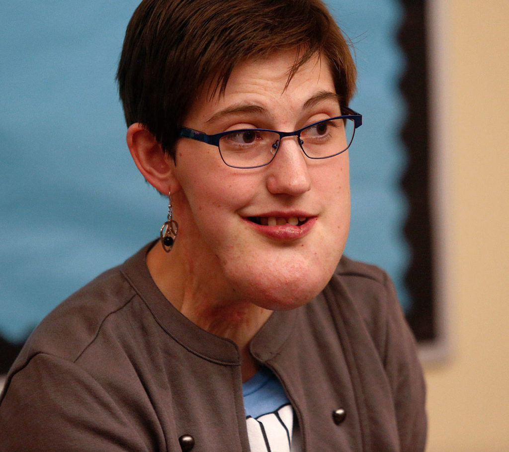 Abby Beauchamp was born with a lymphatic malformation, and has had nearly 30 surgeries in her 24 years. (Dan Bates / The Herald)
