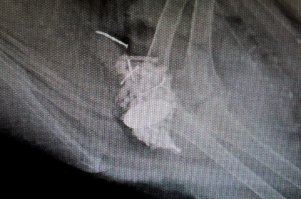 An X-ray shows metallic objects as white areas in a duck’s gizzard prior to surgery. (Andy Bronson / The Herald)
