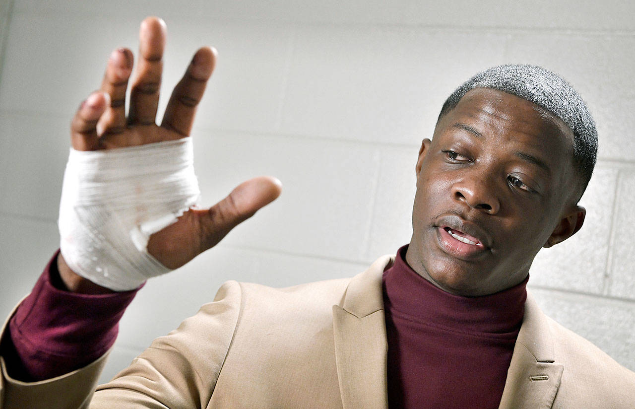 James Shaw Jr. shows his hand that was injured when he disarmed a shooter inside a Waffle House on Sunday in Nashville, Tennessee. (Larry McCormack/The Tennessean via AP)