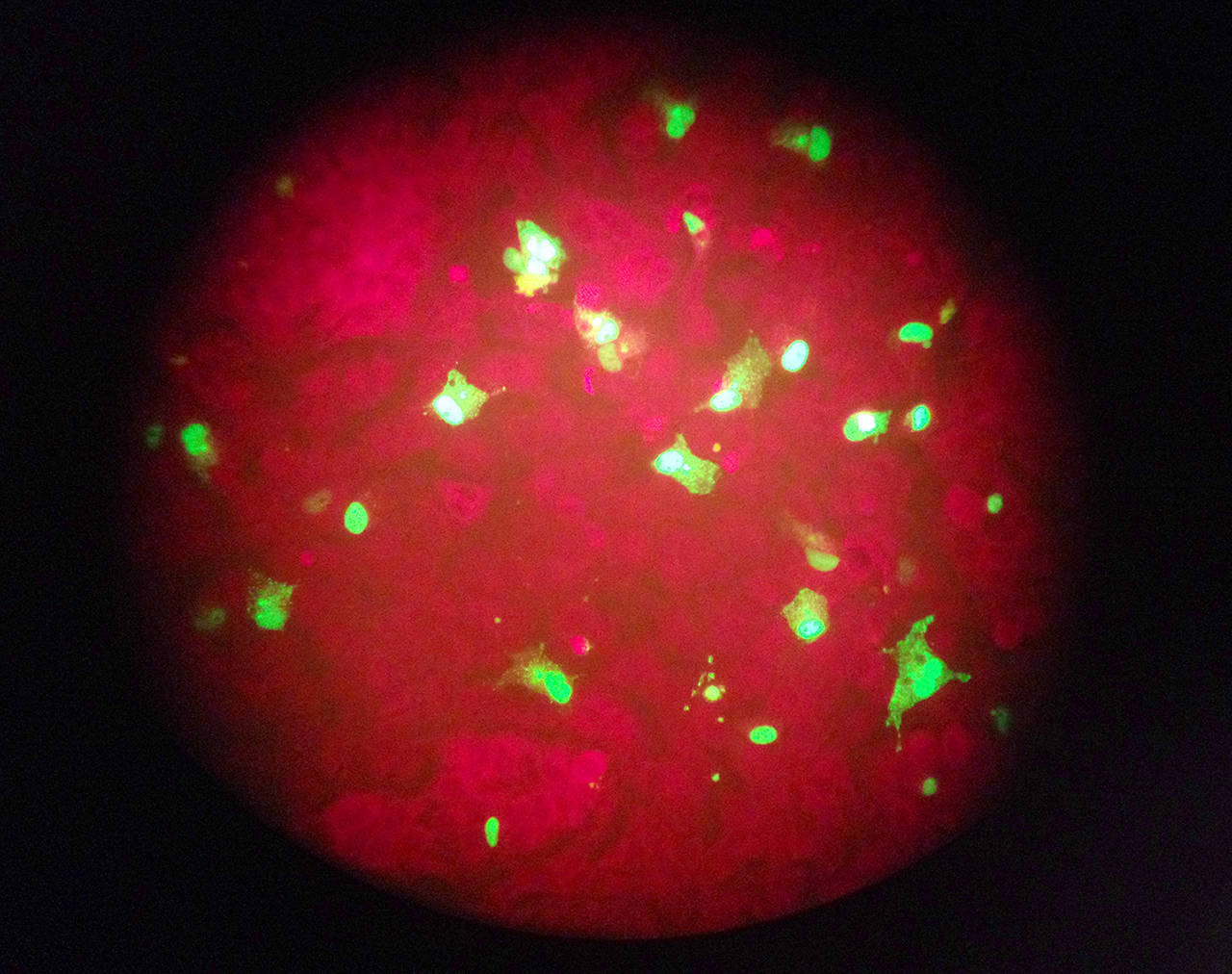 In this 2015 photo taken through the eyepiece of a microscope, human cells infected with the flu virus glow green under light from a fluorescence microscope at a laboratory in Seattle. (Ted S. Warren / AP file)