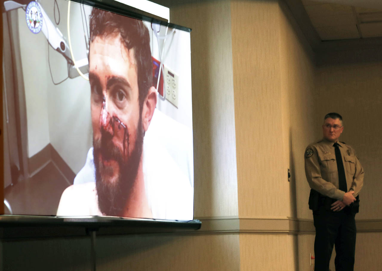 A video is shown with Travis Kauffman showing his facial injuries before his appearance at a news conference Feb. 14 in Fort Collins, Colorado, about his encounter with a mountain lion while running a trail just west of Fort Collins last week. (AP Photo/David Zalubowski)