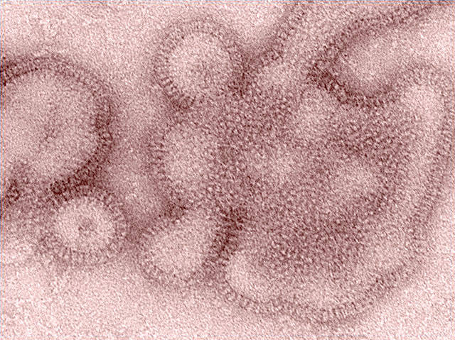 An H3N2 influenza virus. (AP Photo/Centers for Disease Control and Prevention, Dr. Michael Shaw, Doug Jordan)