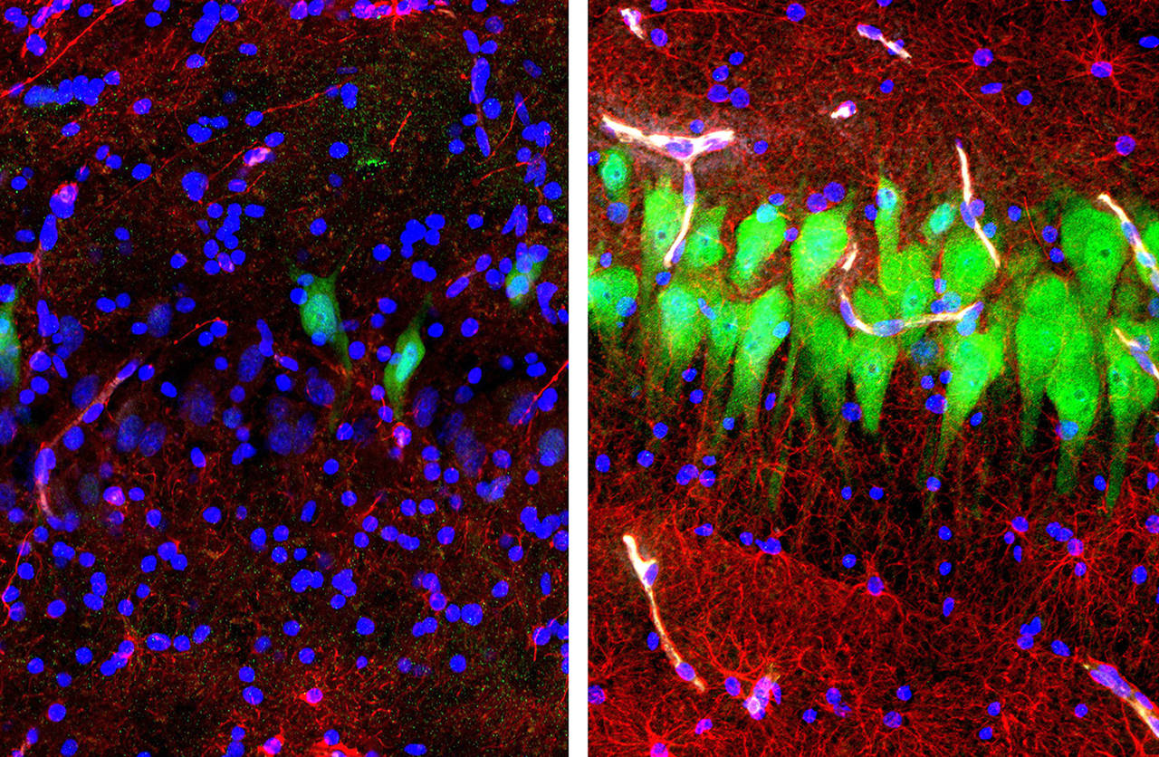 This combination of images shows stained microscope photos of neurons (green), astrocytes (red) and cell nuclei (blue) from a pig brain left untreated for 10 hours after death (left) and another (right) with a specially designed blood substitute pumped through it. (Stefano G. Daniele, Zvonimir Vrselja/Sestan Laboratory/Yale School of Medicine)