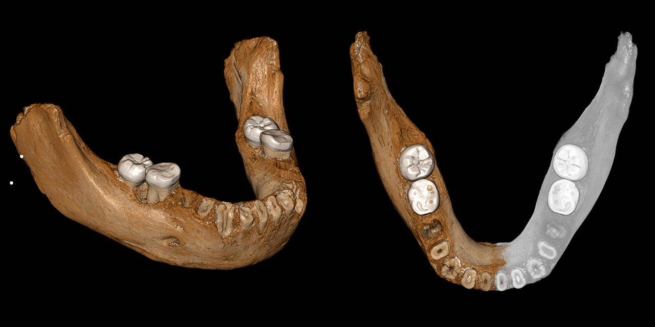 This combination of images provided by the Max Planck Institute for Evolutionary Anthropology, Leipzig shows two views of a virtual reconstruction of the Xiahe mandible. At right, the simulated parts are in gray. According to a report released on Wednesday, May 1, 2019, the bone is at least 160,000 years old, and recovered proteins led scientists to conclude the jaw came from a Denisovan, a relative of Neanderthals. (Jean-Jacques Hublin, MPI-EVA, Leipzig)