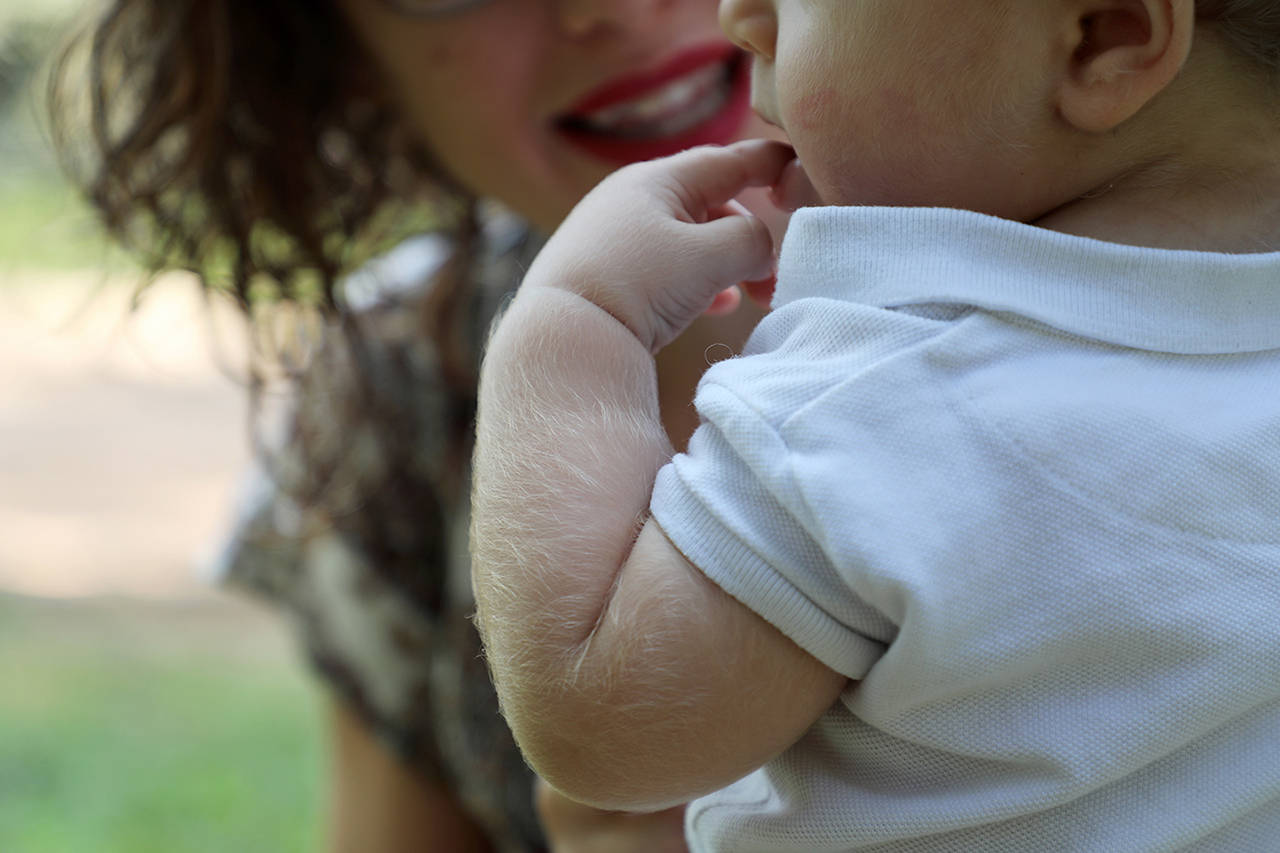 Angela Martínez holds her son Uriel as they walk in a park in Granada, south of Spain, on Saturday. Uriel’s body is covered in hair due to taking a hair-growing medicine containing minoxidil, wrongly labeled as omeprazole. (AP Photo/Sergio Ruiz)
