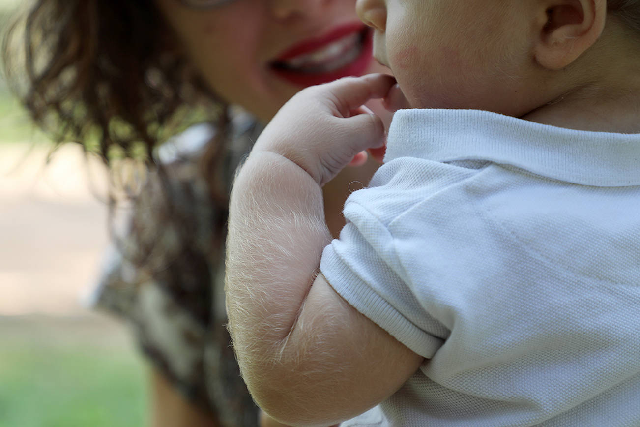 Children grow body hair from alleged drug mixup in Spain