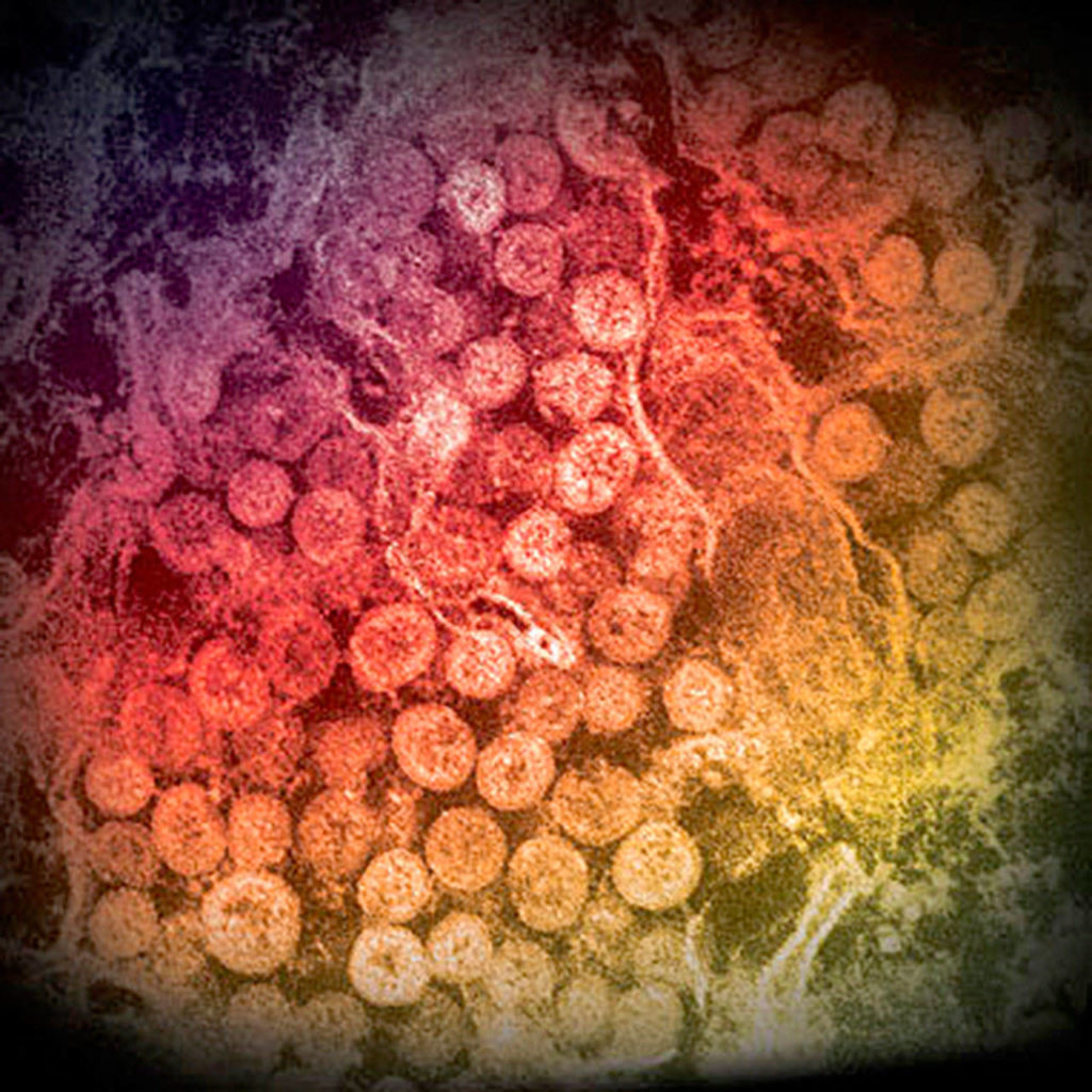 An electron micrograph of a thin section of MERS-CoV, a type of coronavirus similar to the new 2019-nCoV, showing the spherical particles within the cytoplasm of an infected cell. (Cynthia Goldsmith/Azaibi Tamin)
