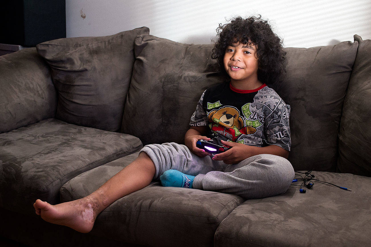 Dayvion Escalante, 9, plays Fortnite at home on Thursday, Nov. 19, 2020 in Everett, Washington. Dayvion was seven when he was severely burned on his leg and foot while drinking hot apple cider. He required a two month stay in the hospital.  (Andy Bronson / The Herald)