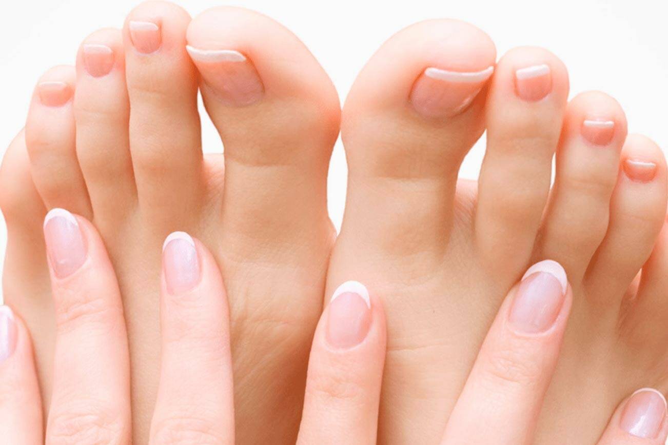 Best Fungus Supplements Top Toenail Fungus Treatment Products Heraldnet Com