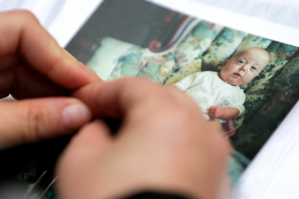 Sadie was born with a serious heart defect that required surgery. (Kevin Clark / The Herald)
