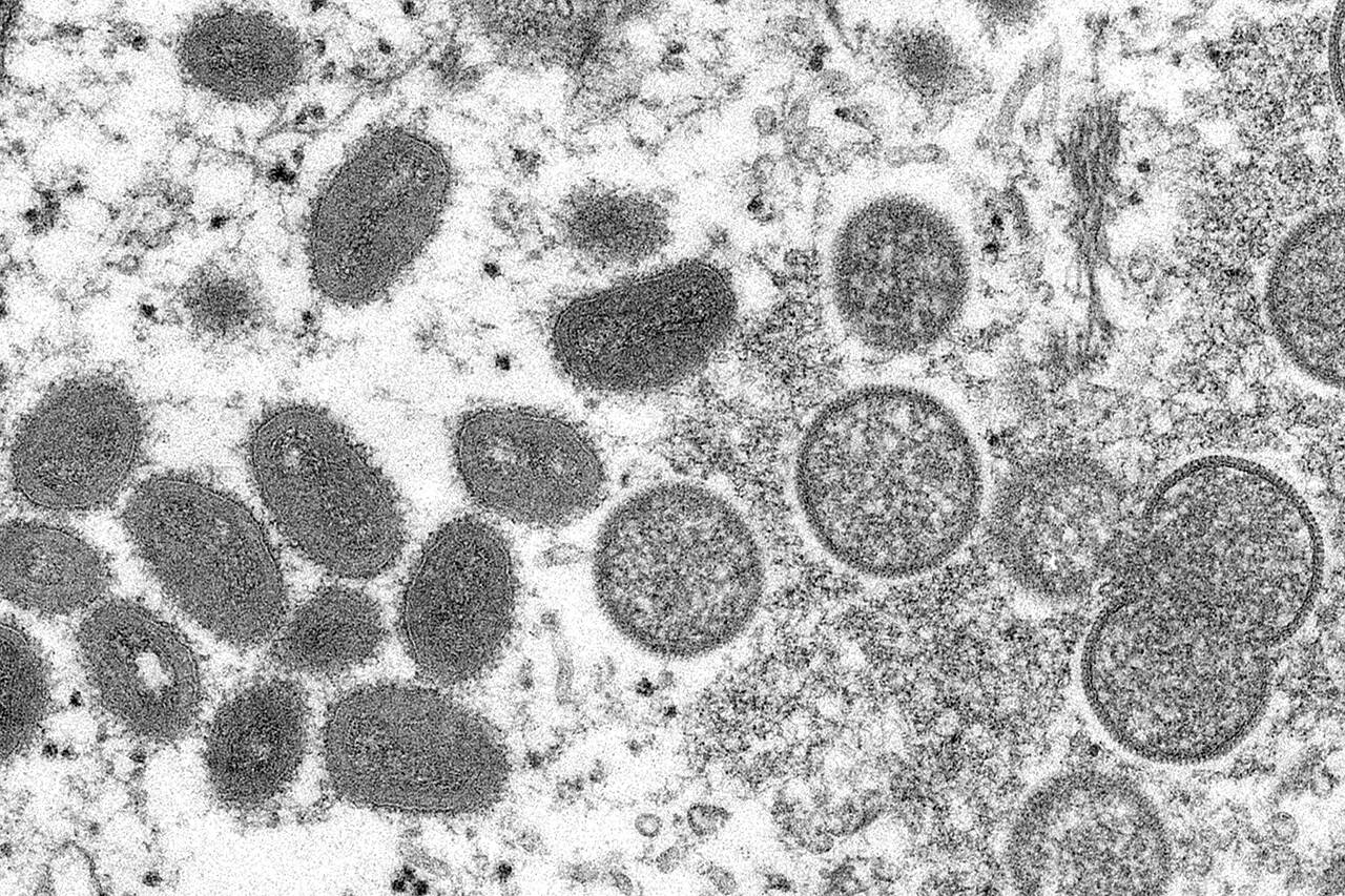 This 2003 electron microscope image made available by the Centers for Disease Control and Prevention shows mature, oval-shaped monkeypox virions, left, and spherical immature virions, right, obtained from a sample of human skin associated with the 2003 prairie dog outbreak. (Cynthia S. Goldsmith, Russell Regner / CDC via AP, File)