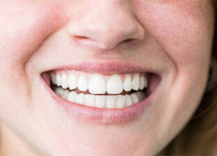 With the Smile Makeover promotion from Om3 Oral Maxillofacial and Implant Surgery and Schmidt Advanced Dentistry, Board-certified oral and maxillofacial surgeons Dr. Peter Kim and Dr. Serv Wahan, and dentist and prosthodontist Dr. Kyle Schmidt, will provide a full set of dental implants to someone who has lost their own teeth.