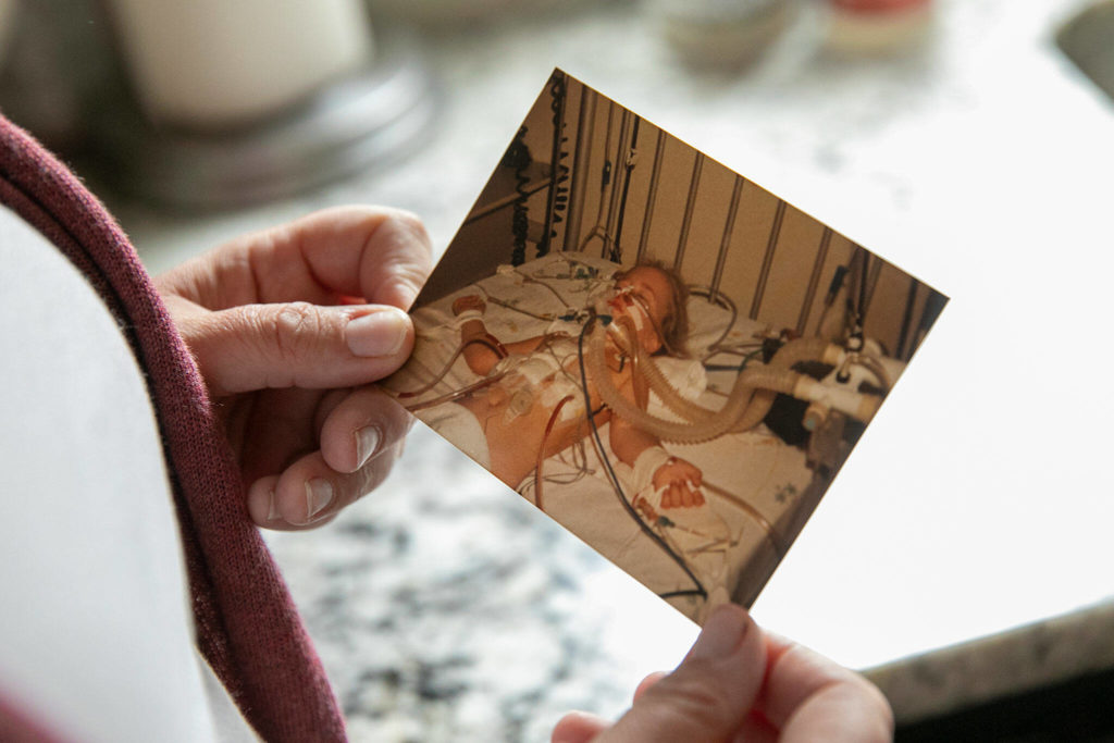 Marie Riley, 42, holds an image of herself as a child after an open-heart surgery on Oct. 25, at her family’s home in North Bend. Riley was born with tetralogy of fallot, a rare congenital heart condition that has required multiple surgeries during her lifetime. (Ryan Berry / The Herald) 
