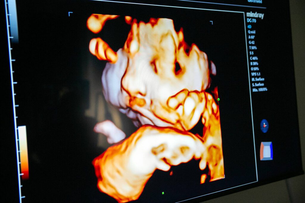 A live rendering of Franchesca and Don Simpson’s child is displayed on a large screen while Kelly Fox does an ultrasound at Wonder Baby Ultrasound Studio in Everett. Fox, the owner of Wonder Baby, is able to collect still images during the live “4D” ultrasounds which she can then share with expectant couples. (Ryan Berry / The Herald)
