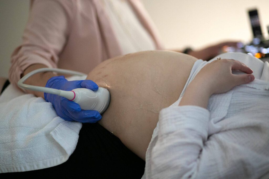 Kelly Fox performs an ultrasound on expectanr mother Franchesca Simpson at Wonder Baby Ultrasound Studio in Everett. (Ryan Berry / The Herald)
