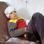 This frame grab from video shows a child on a hospital bed, with a bandage around his head, after airstrikes killed over 20 people, in the northern rebel-held village of Hass, Syria, on Wednesday, Oct 26. (Muaz al-Shami, Syrian Revolution Network, via AP)