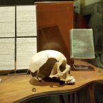 The skull of one Ellen Jones, whose head was bashed in with an ax in 1863 (Christina Okeson / The Herald)