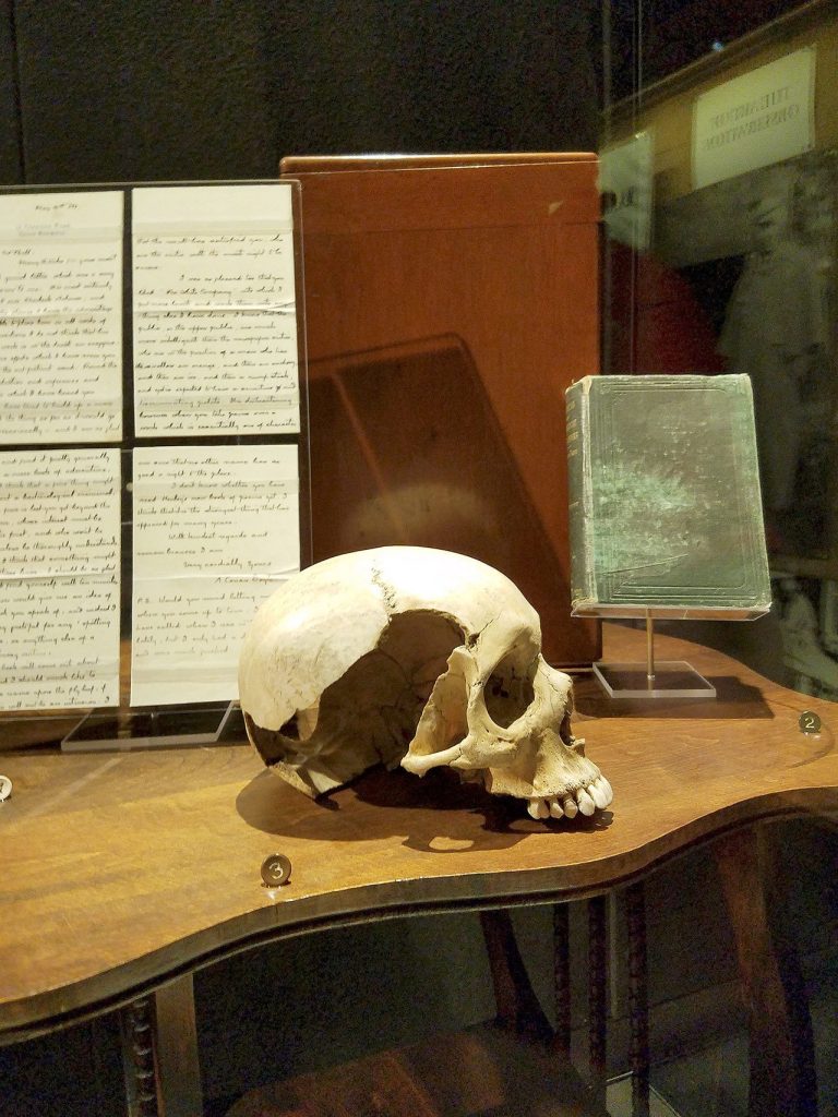 The skull of one Ellen Jones, whose head was bashed in with an ax in 1863 (Christina Okeson / The Herald)