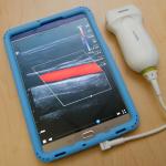 Medical devices made in county one of state’s top exports