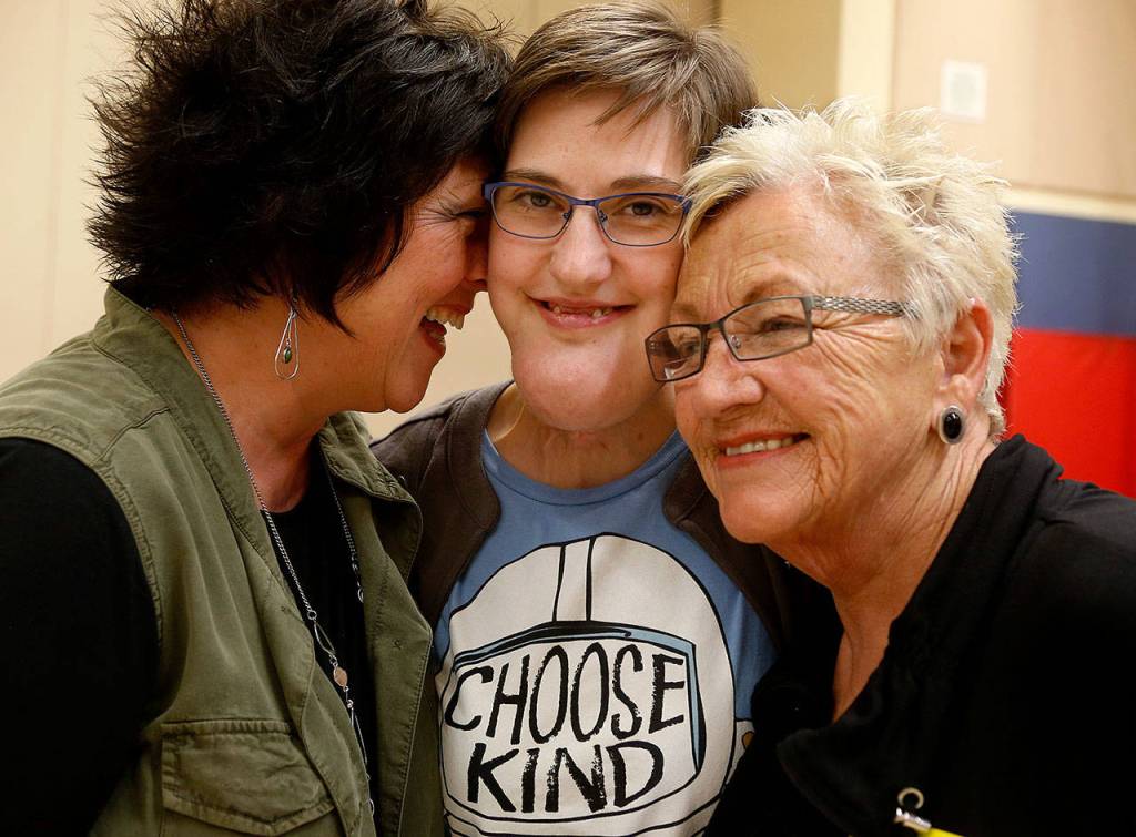 Supported by her mother, Sarah Beauchamp (left) and grandmother, Dee Anderson, Abby Beauchamp visits Hillcrest Elementary School in Lake Stevens on Friday, and talks with kids about her life with a facial condition that has brought her negative attention. (Dan Bates / The Herald)