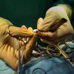 Dr. Anneliese Strunk holds a small metal disk removed from a ducks gizzard during surgery. (Andy Bronson / The Herald)