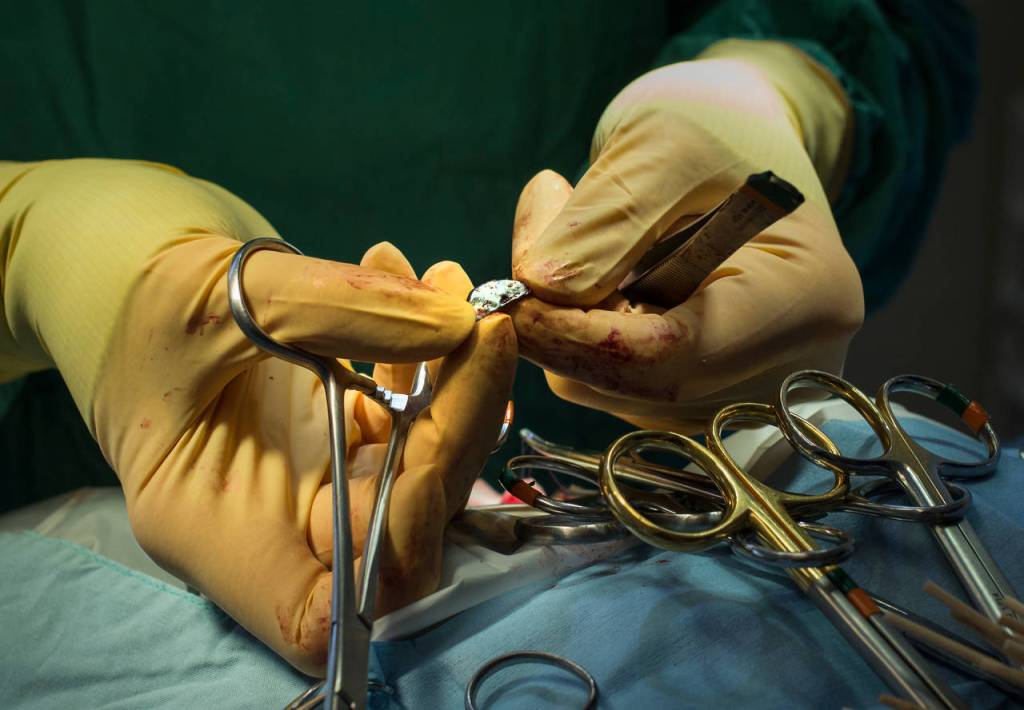 Dr. Anneliese Strunk holds a small metal disk removed from a ducks gizzard during surgery. (Andy Bronson / The Herald)