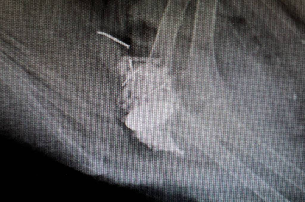 An X-ray shows metallic objects as white areas in a ducks gizzard prior to surgery. (Andy Bronson / The Herald)