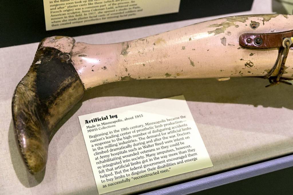 Amputations during WWI led to advancements in prosthetics. (Kevin Clark / The Herald)