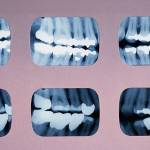 Editorial: Cavities to fill in state corporate dentistry law