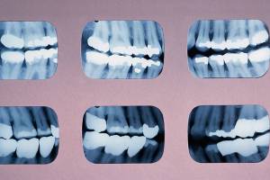 Editorial: Cavities to fill in state corporate dentistry law