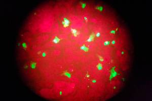 First flu death of the season reported in Snohomish County