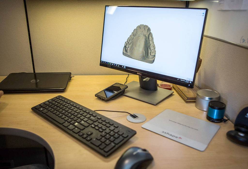 An impression scan used for 3-D printing is displayed at Valley Orthodontic Laboratory in Snohomish. (Olivia Vanni / The Herald)