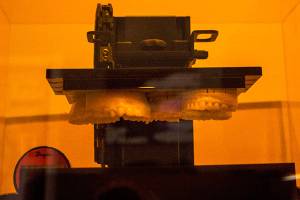 3-D printing takes the bite out of visits to the dentist
