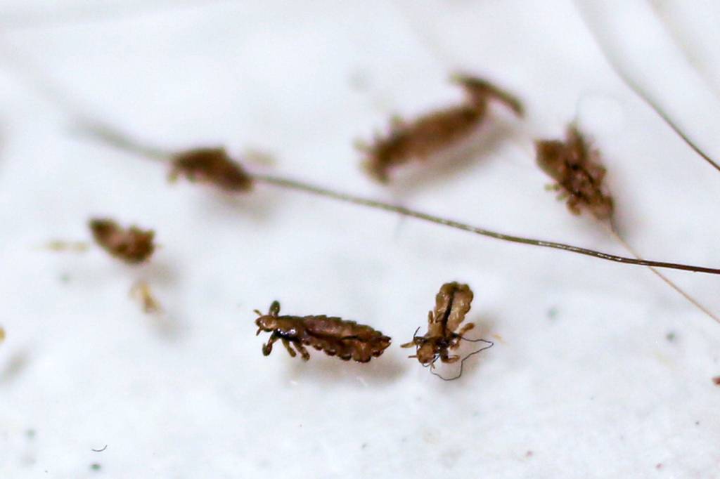 Dead lice await examination at Lice Spies. (Kevin Clark / The Herald)