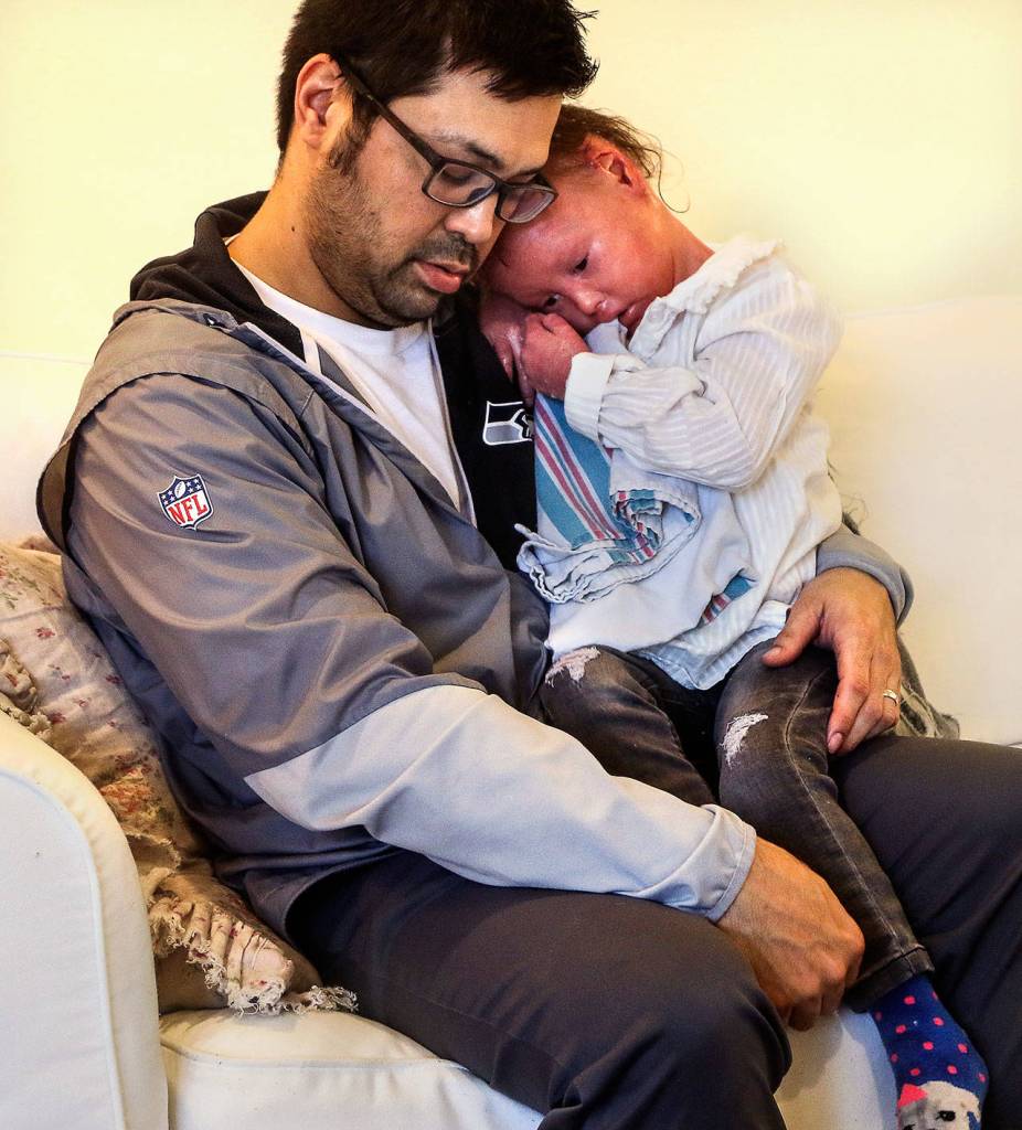 Kevin Foy and his 4-year-old daughter Harper both look tuckered out after a busy morning in their Edmonds home. Harper was born with a rare genetic condition that affects her skin. At birth she was covered with armor-like plaques and needs frequent baths and other vital care. (Dan Bates / The Herald)