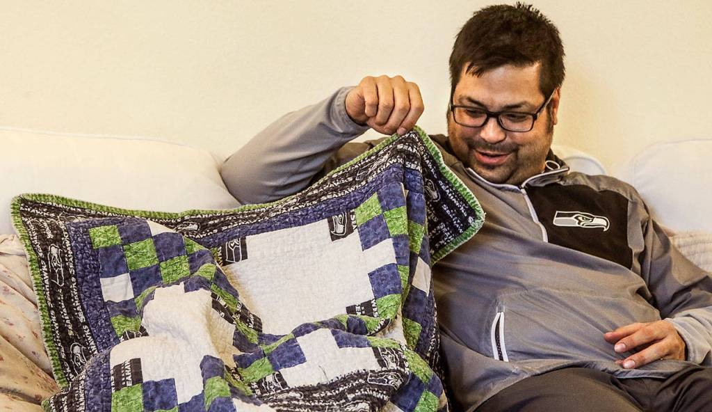 Kevin Foy takes a peek at 4-year-old daughter Harper, who hid under a blanket Wednesday after bumping her head during play. The Edmonds girl was born with a rare genetic condition that affects her skin and requires round-the-clock care. (Dan Bates / The Herald)