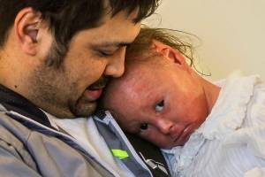 Edmonds girl, 4, has beauty that’s ‘more than skin deep’