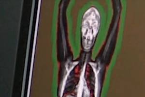 Body scanner could replace strip searches in Monroe prison