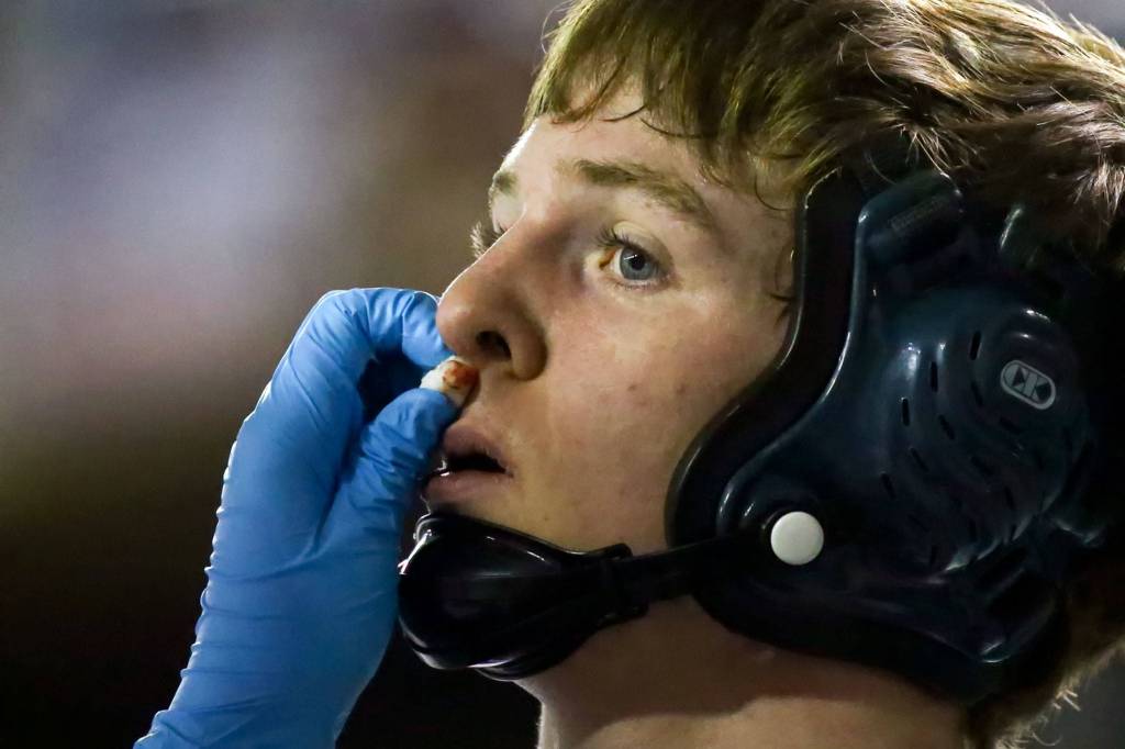 Edmonds-Woodway&rsquo;s Howie Hare get medical attention during Day 1 of Mat Classic XXXII Friday at the Tacoma Dome. (Kevin Clark / The Herald)
