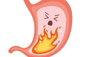 Human stomach on fire. Heartburn, gastritis and acid reflux, indigestion and stomach pain problems. Vector flat cartoon illustration on white background